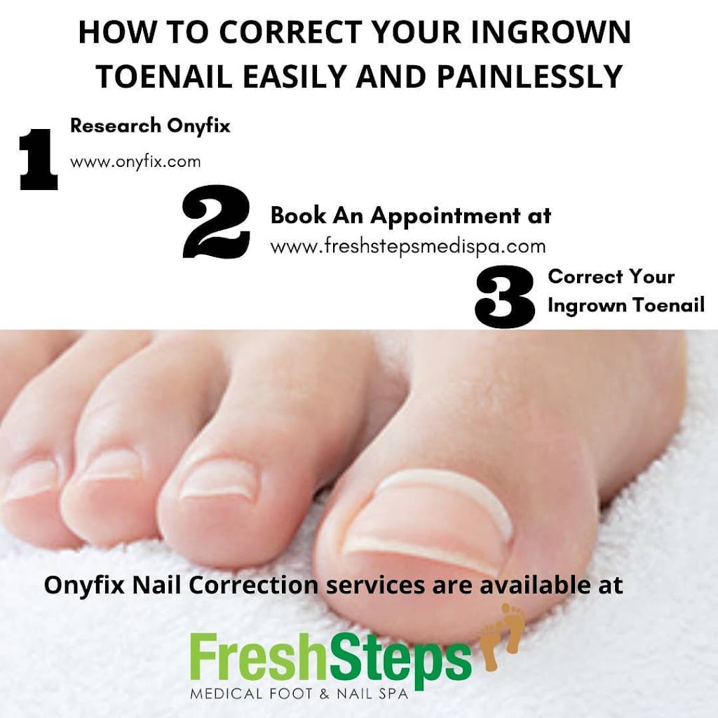 FreshSteps Medical Foot and Nail Spa | 7651 Eldorado Pkwy Suite 100-E, McKinney, TX 75070, USA | Phone: (469) 850-1520