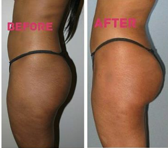 Summerbody Glow Studio | 1120 Breezy Knoll St, Minneola, FL 34715, USA | Phone: (407) 486-7303