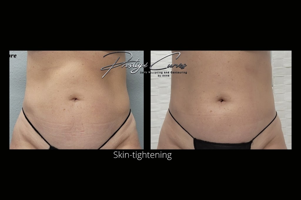 Prestigé Curves Body Sculpting | 520 W Lacey Blvd #3, Hanford, CA 93230, USA | Phone: (559) 904-9943