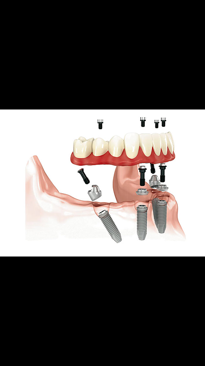 My OC Dental Care | 13732 S Euclid St, Garden Grove, CA 92843 | Phone: (714) 530-0921