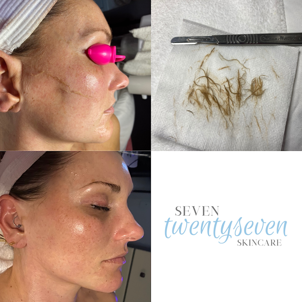 seven twentyseven skincare | 311 Poplar View Ln W Ste 1, Collierville, TN 38017, USA | Phone: (901) 316-8351