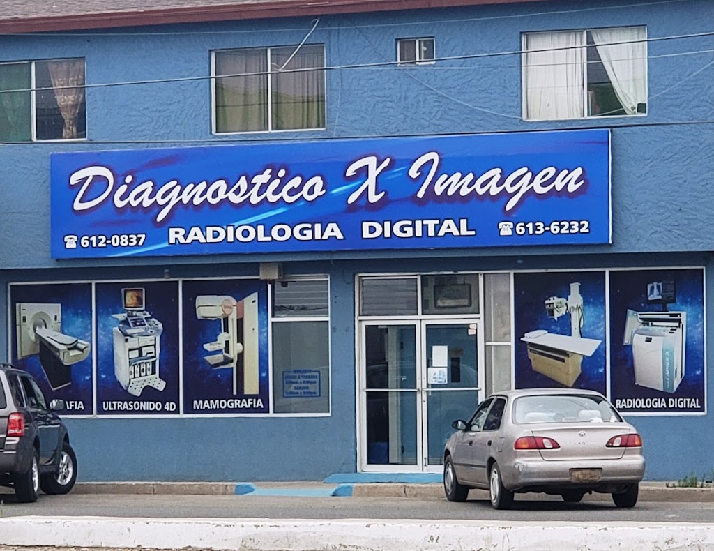 Diagnostico X Imagen S.A. de C.V. | Blvd. Benito Juárez 38-4, Mexicali, 22703 Rosarito, B.C., Mexico | Phone: 661 612 0837