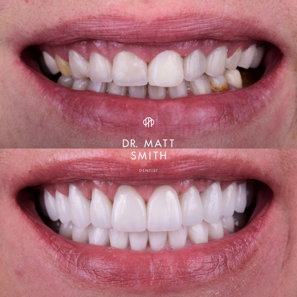 Dr. Matt Smith Stone Ridge Dental | N14W23755 Stone Ridge Dr #260, Waukesha, WI 53188, USA | Phone: (262) 226-8733