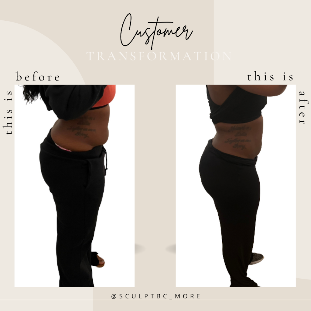 Sculpt Body Contouring & More | 609 N Pacific Coast Hwy Suite 121, Redondo Beach, CA 90277, USA | Phone: (424) 310-4219