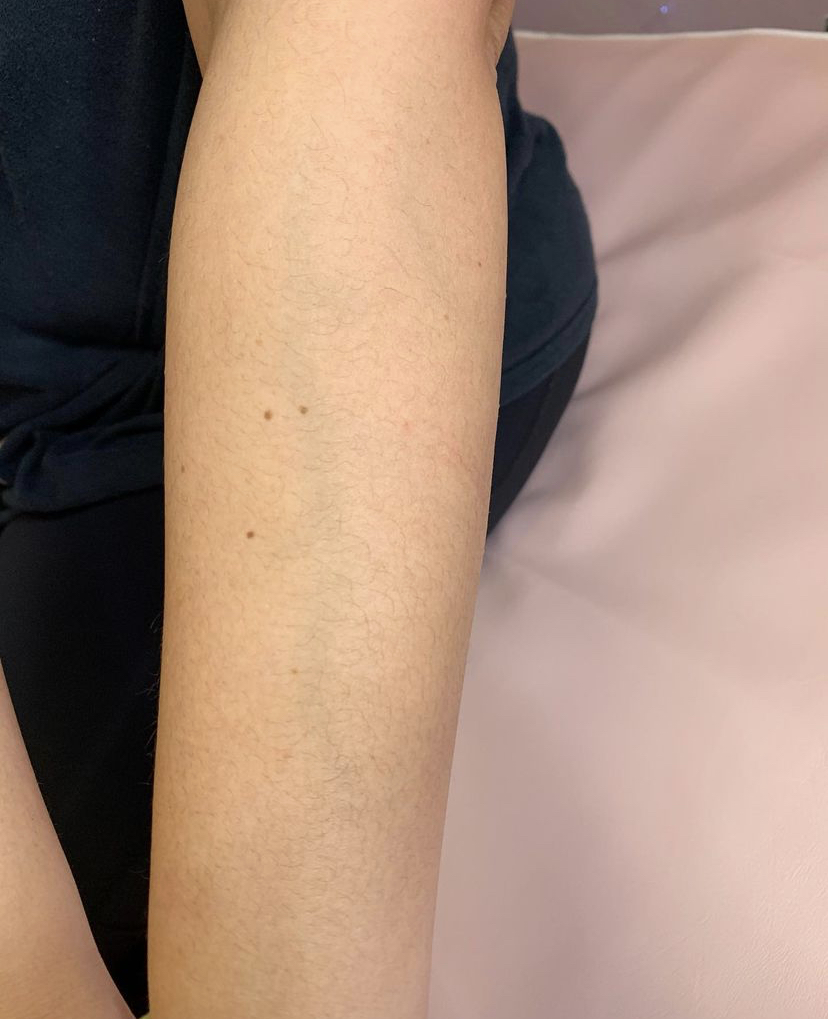 Dream Esthetics | 740 Texas St, Fairfield, CA 94534, USA | Phone: (707) 631-3583