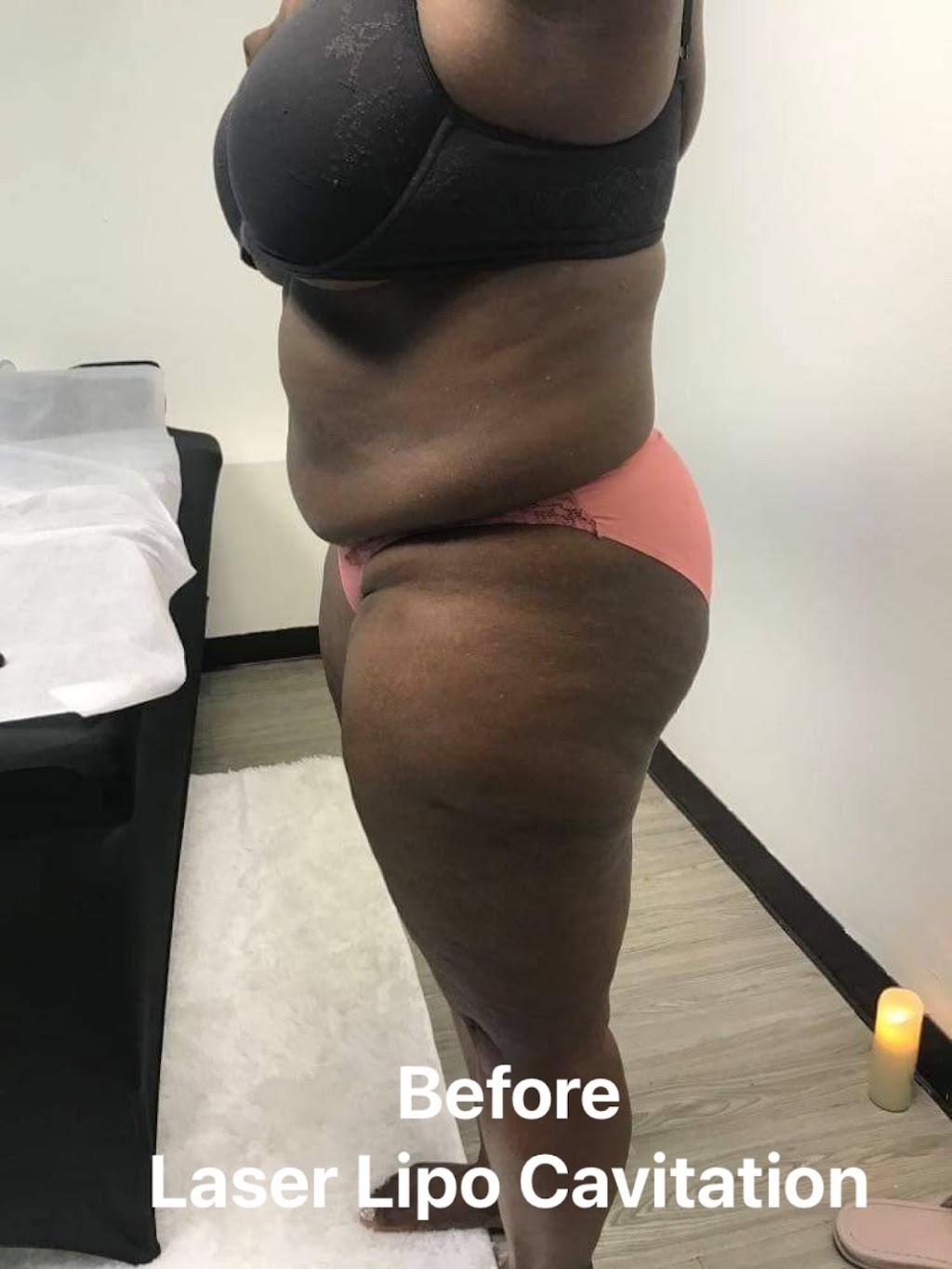 My Preferred Body Spa - Body Sculpting (In Office or Mobile) | 3535 Marvin D. Love Fwy #1, Dallas, TX 75224, USA | Phone: (469) 409-4545