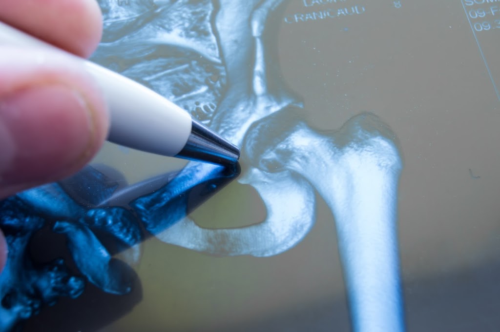 Daniel C. Allison MD, FACS | 444 S San Vicente Blvd # 603, Los Angeles, CA 90048, USA | Phone: (310) 600-7176
