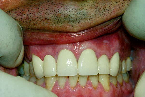 Tarsem L Singhal A Dental Corporation | 5370 Schaefer Ave suite c, Chino, CA 91710, USA | Phone: (909) 548-6200