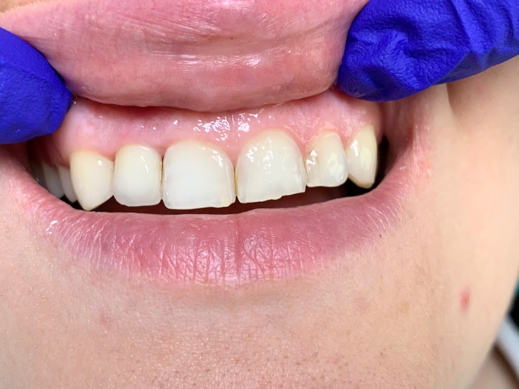 Custom Dental Arts | 2927 Salvio St, Concord, CA 94519, USA | Phone: (925) 285-9555