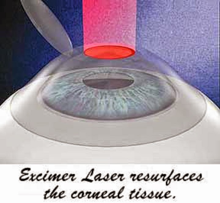 Laser Eye Center of Lubbock | 4804 S Loop 289, Lubbock, TX 79414, USA | Phone: (806) 788-1000