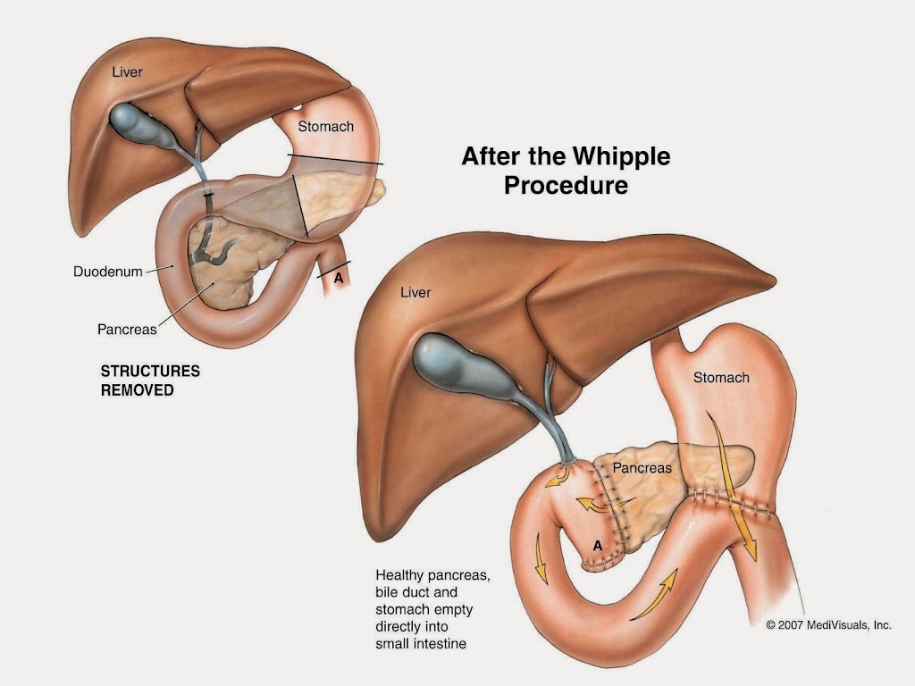 AZ TRANSPLANT ASSOCIATES | 2218 N 3rd St Ac, Phoenix, AZ 85004, USA | Phone: (602) 252-2543