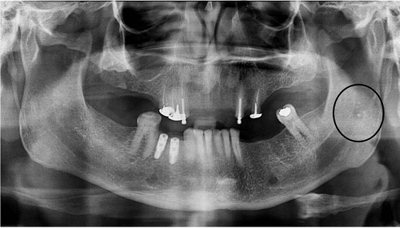 Nice Dental, Shiyu Wang, DDS, San Leandro | 299 Juana Ave # A, San Leandro, CA 94577, USA | Phone: (510) 969-7686