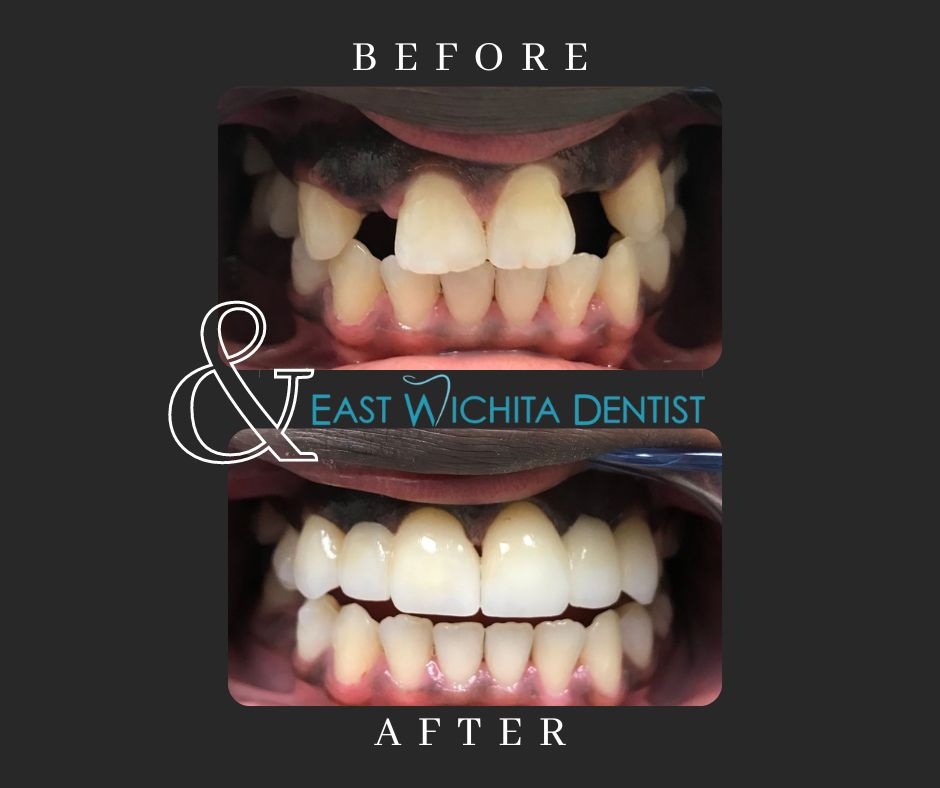 East Wichita Dentist | 8150 E Douglas Ave UNIT 10, Wichita, KS 67206, USA | Phone: (316) 686-7395