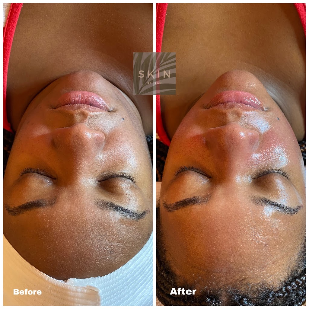 Skin By Cam, LLC | 4600 Powder Mill Rd Suite 450-S32, Beltsville, MD 20705, USA | Phone: (443) 765-1064