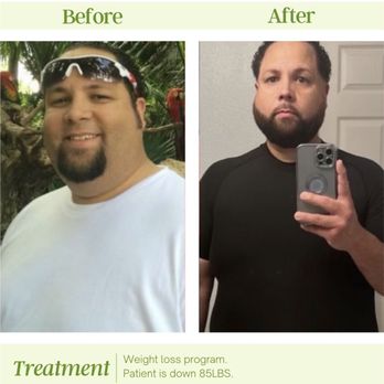 Rejuvenate & Wellness Center Lakeland | 4019 US Hwy 98 N Suite 124, Lakeland, FL 33809, USA | Phone: (321) 294-3586