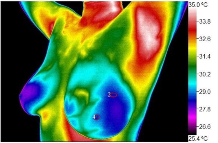 InfraRead: Thermography for Wellness | 8700 Auburn Folsom Rd suite 300, Granite Bay, CA 95746, USA | Phone: (916) 741-2522