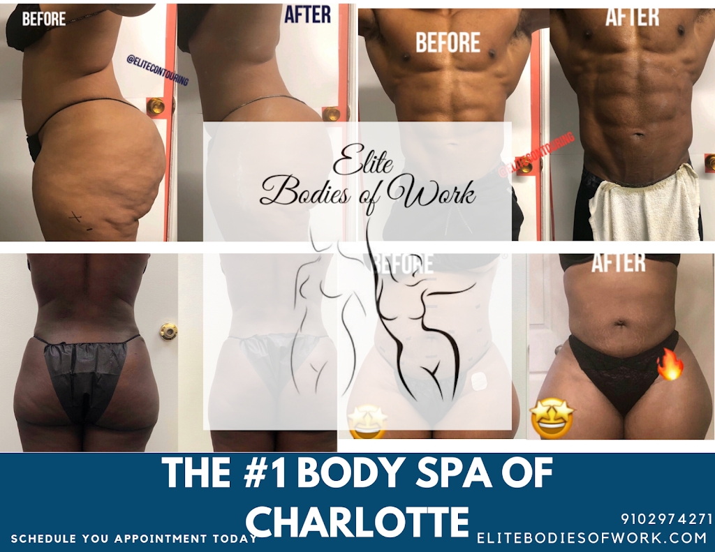 Elite Bodies of Work | 7731 Little Ave Unit A, Charlotte, NC 28226, USA | Phone: (980) 585-6878