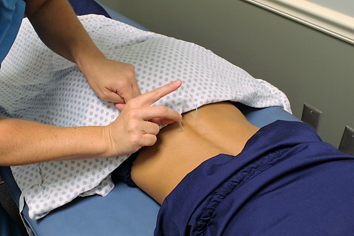 Chiropractic Acupuncture Health Center | 2224 Cahaba Valley Dr STE B3, Birmingham, AL 35242, USA | Phone: (205) 408-5600