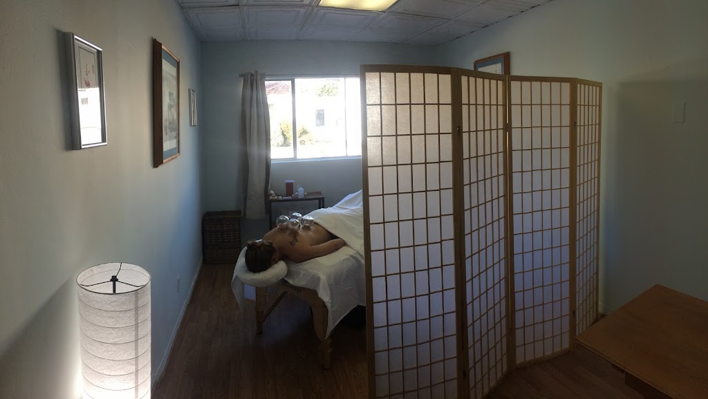 Enso Acupuncture | 1900 Sunset Dr # J, Escondido, CA 92025, USA | Phone: (619) 357-3057