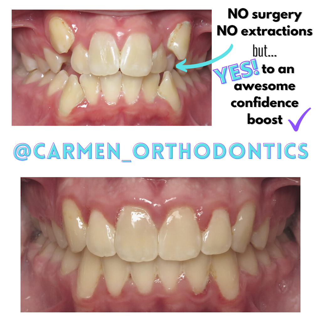 Carmen Orthodontics | 177 W Columbus St, Pickerington, OH 43147, USA | Phone: (614) 833-5004