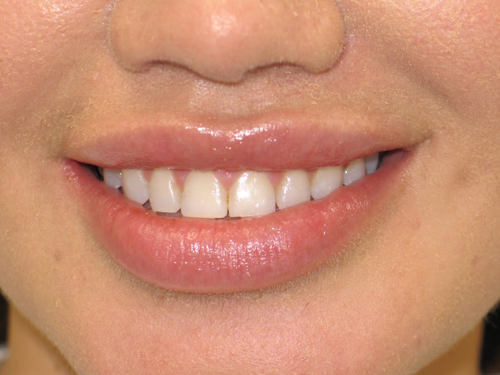 Smile Shapers Dental: Dr. Eva M. Goriee | 44627 Mound Rd, Sterling Heights, MI 48314, USA | Phone: (586) 323-7201