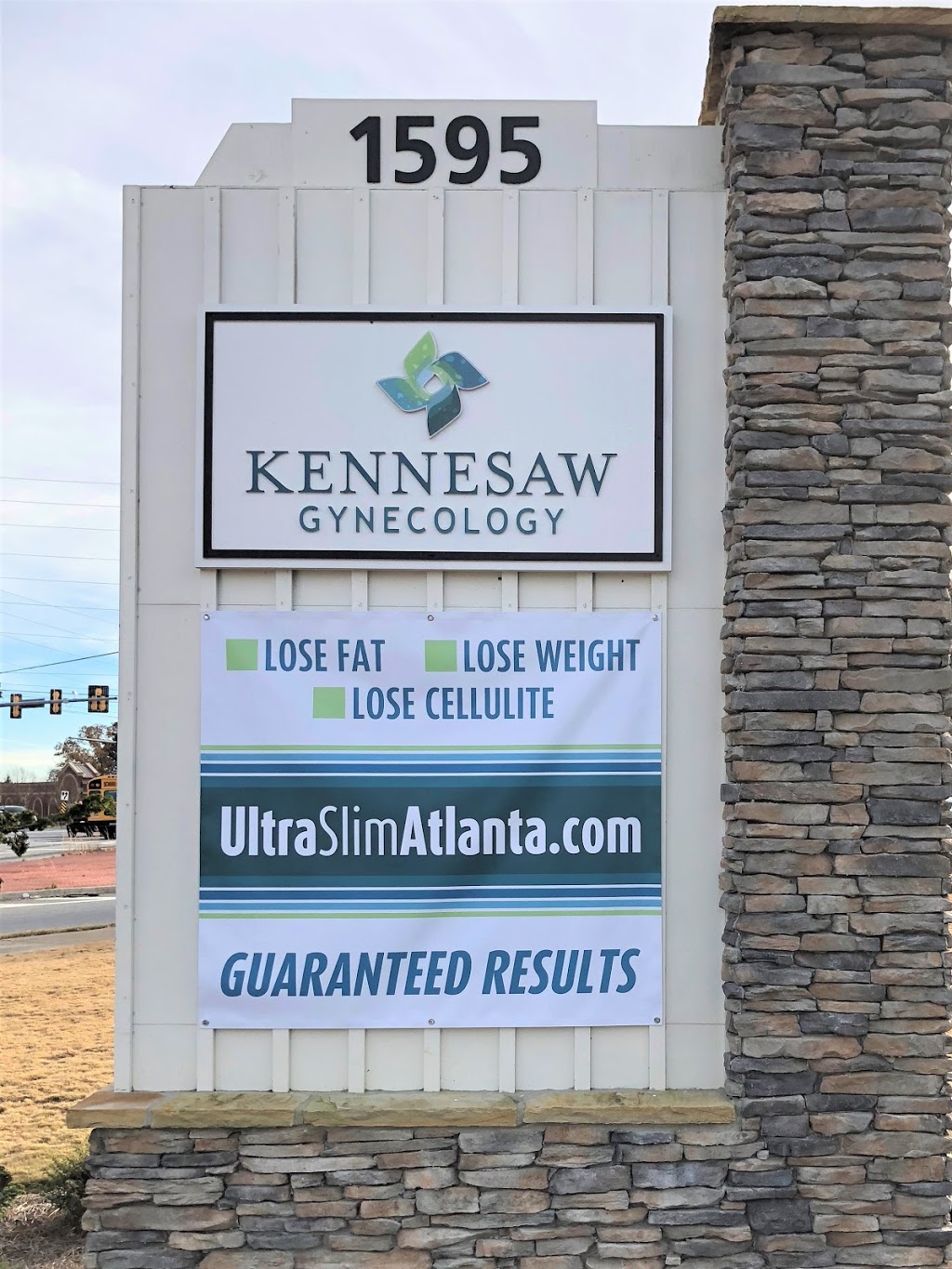 UltraSlim Atlanta Body Contouring | 1595 Kennesaw Due West Rd NW, Kennesaw, GA 30152 | Phone: (470) 308-3365