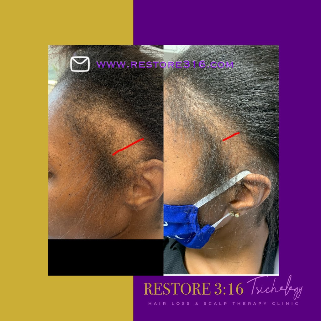 Restore 3:16 Trichology | 6720 167th St Suite 1, Tinley Park, IL 60477, USA | Phone: (708) 316-1630