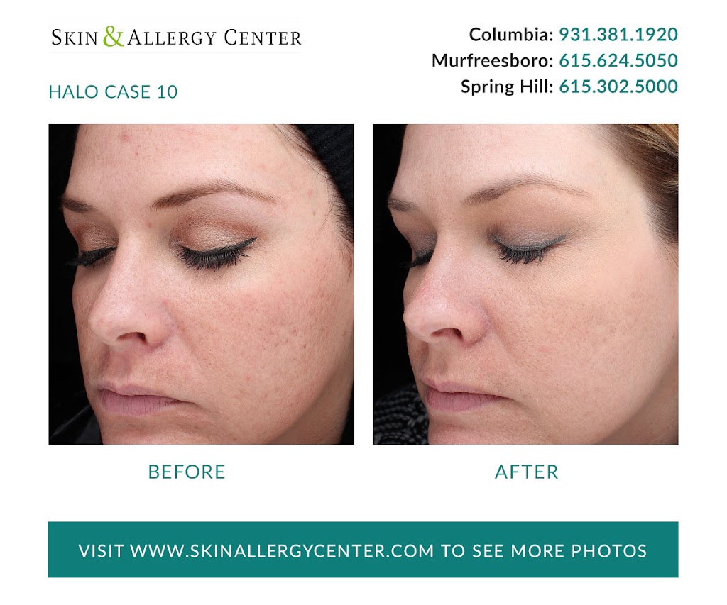 Skin & Allergy Center | 1229 Reserve Blvd Suite 200, Spring Hill, TN 37174, USA | Phone: (615) 302-5000