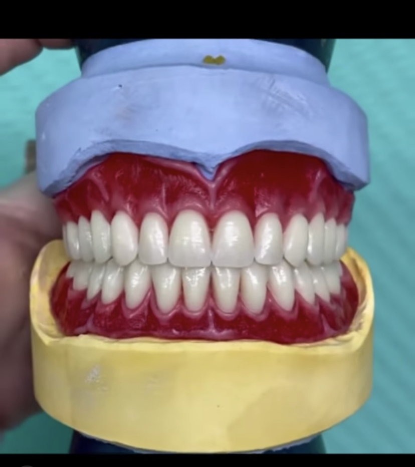 Martigon Dental Lab | 12684 Atherton Dr, Moreno Valley, CA 92555, USA | Phone: (951) 247-3459