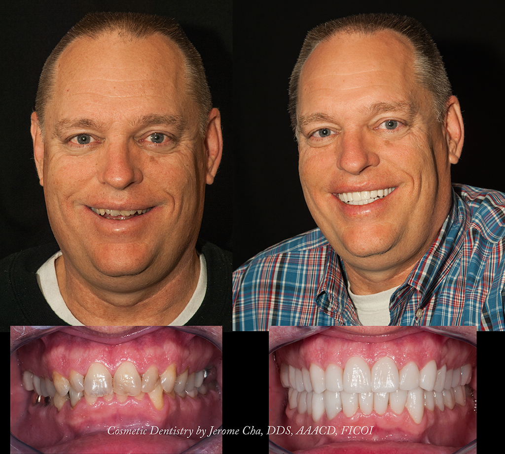 Hope Restorative and Cosmetic Dentistry | 9445 S Mingo Rd, Tulsa, OK 74133, USA | Phone: (918) 286-7776