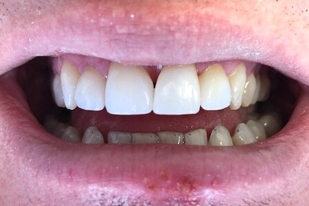 Cambridge Dentistry | Dr. Joseph A. Ruggirello | 17016 25 Mile Rd, Macomb, MI 48042, USA | Phone: (586) 677-7944