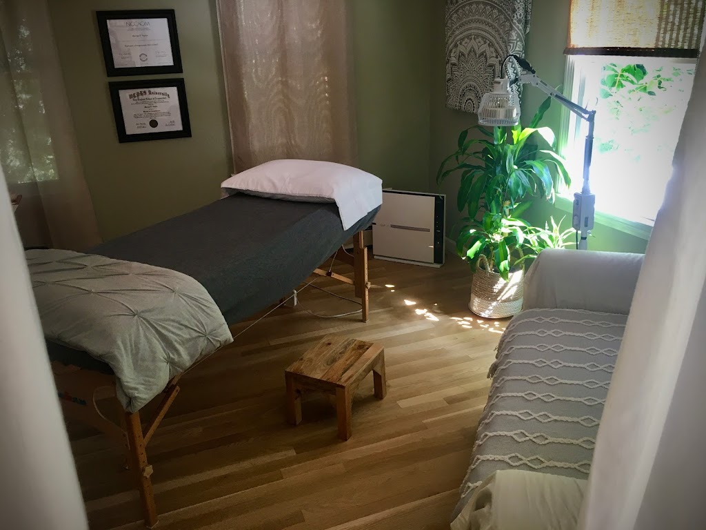 MT360 Acupuncture | 43 Maple St, Norfolk, MA 02056 | Phone: (508) 446-7107