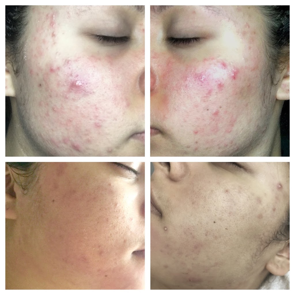 Body by Shae | 1629 Lee Rd, Winter Park, FL 32789, USA | Phone: (407) 256-8669