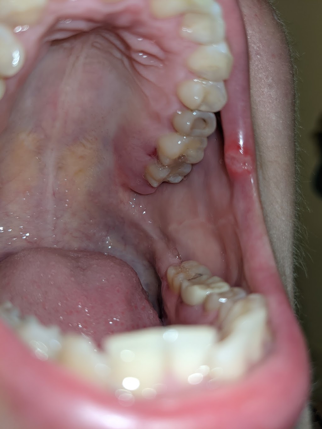 Bethel Family Dentistry | 420 W Plane St, Bethel, OH 45106, USA | Phone: (513) 734-2029