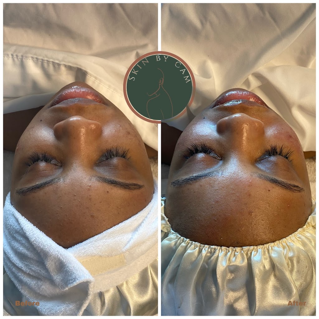 Skin By Cam, LLC | 4600 Powder Mill Rd Suite 450-S32, Beltsville, MD 20705, USA | Phone: (443) 765-1064