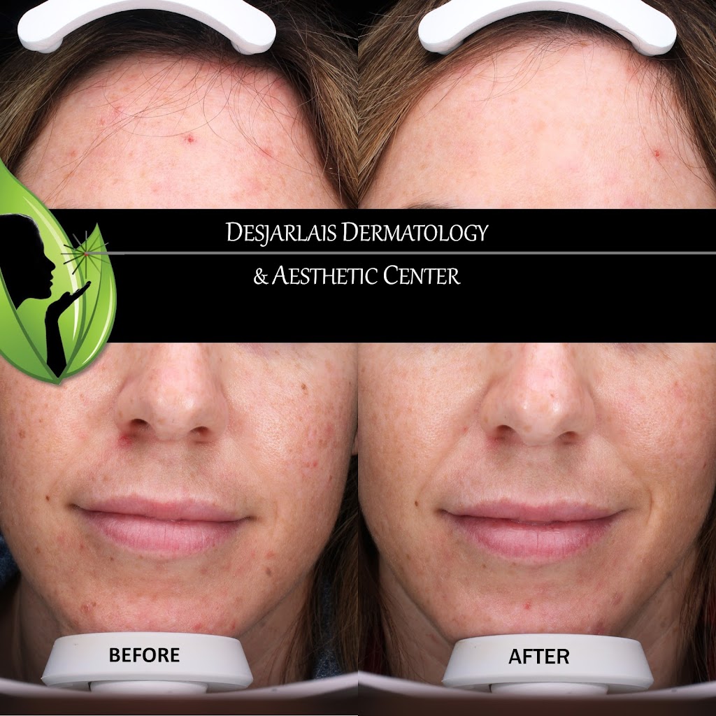 Desjarlais Dermatology & Aesthetic Center | 2000 Curtis Rd, Adrian, MI 49221, USA | Phone: (517) 264-5603