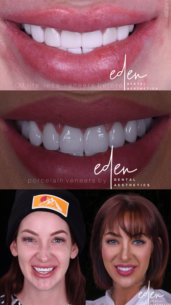 Eden Dental Aesthetics | 12603 Henderson Rd, Tampa, FL 33625, USA | Phone: (813) 962-2731