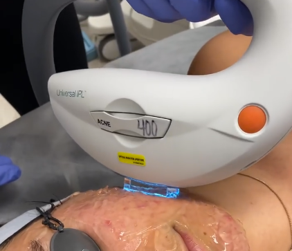 AZ Laser Studio & Medspa | 1061 N Dobson Rd #108, Mesa, AZ 85201, USA | Phone: (480) 450-4809