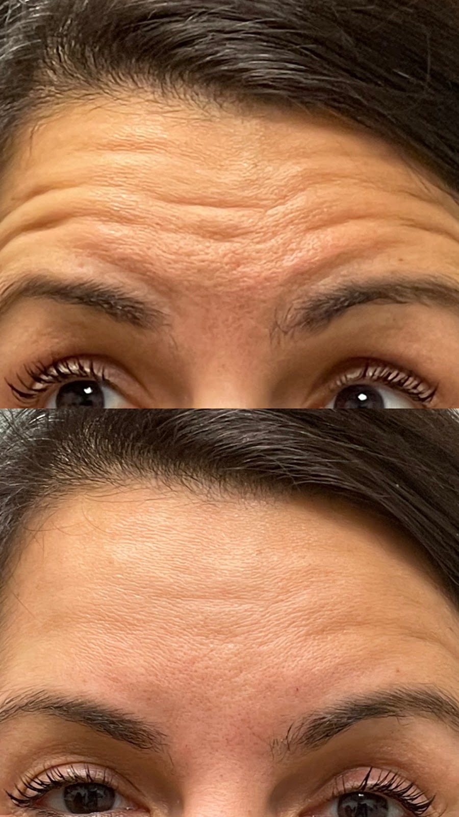 Island Plastic Surgery | 190 E Jericho Turnpike Suite 202, Mineola, NY 11501, USA | Phone: (516) 977-9922