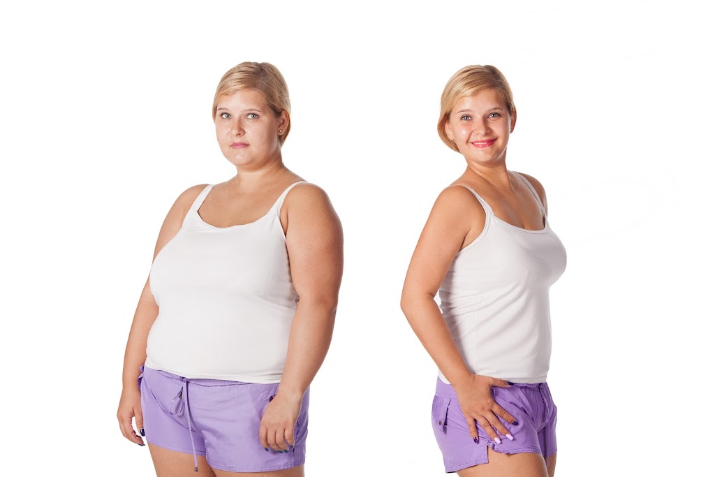 Gastric Sleeve Dallas | 5950 Lindenshire Ln APT 104, Dallas, TX 75230, USA | Phone: (214) 385-5500