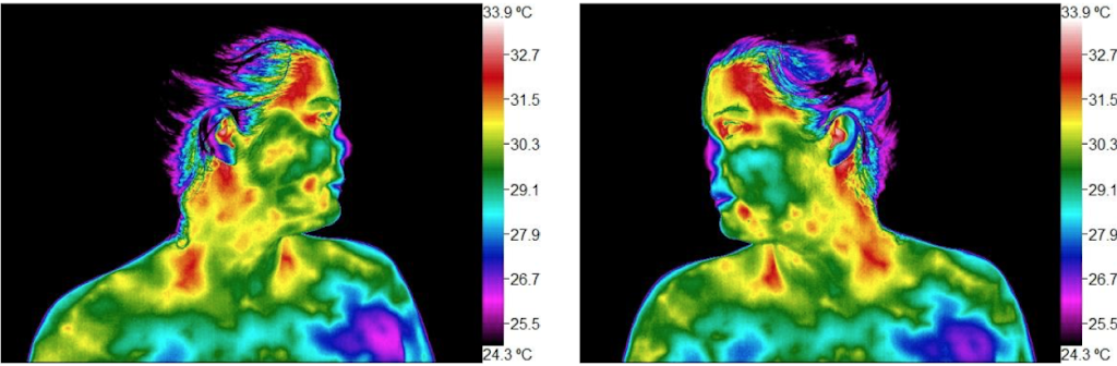 InfraRead: Thermography for Wellness | 8700 Auburn Folsom Rd suite 300, Granite Bay, CA 95746, USA | Phone: (916) 741-2522