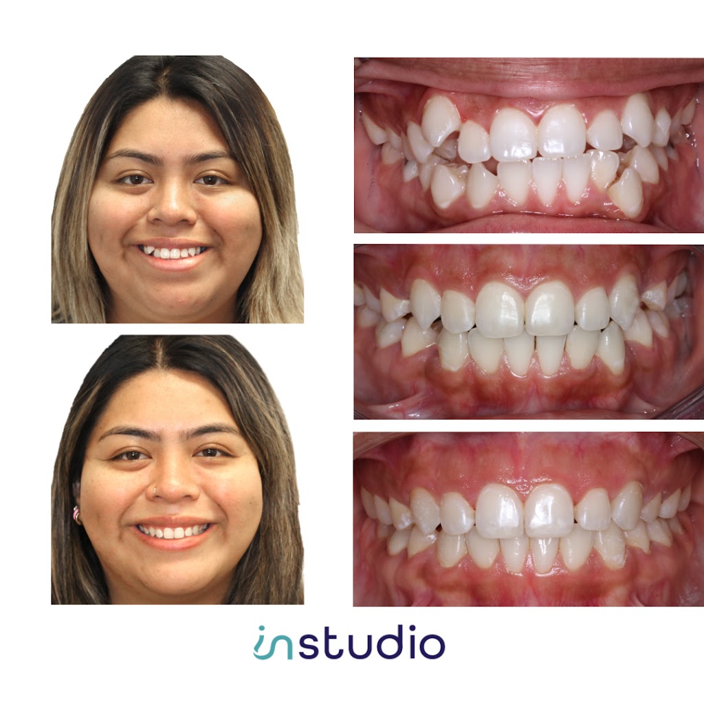 InStudio Orthodontics | 111 Academy Wy Suite 150, Irvine, CA 92617, USA | Phone: (949) 877-7753