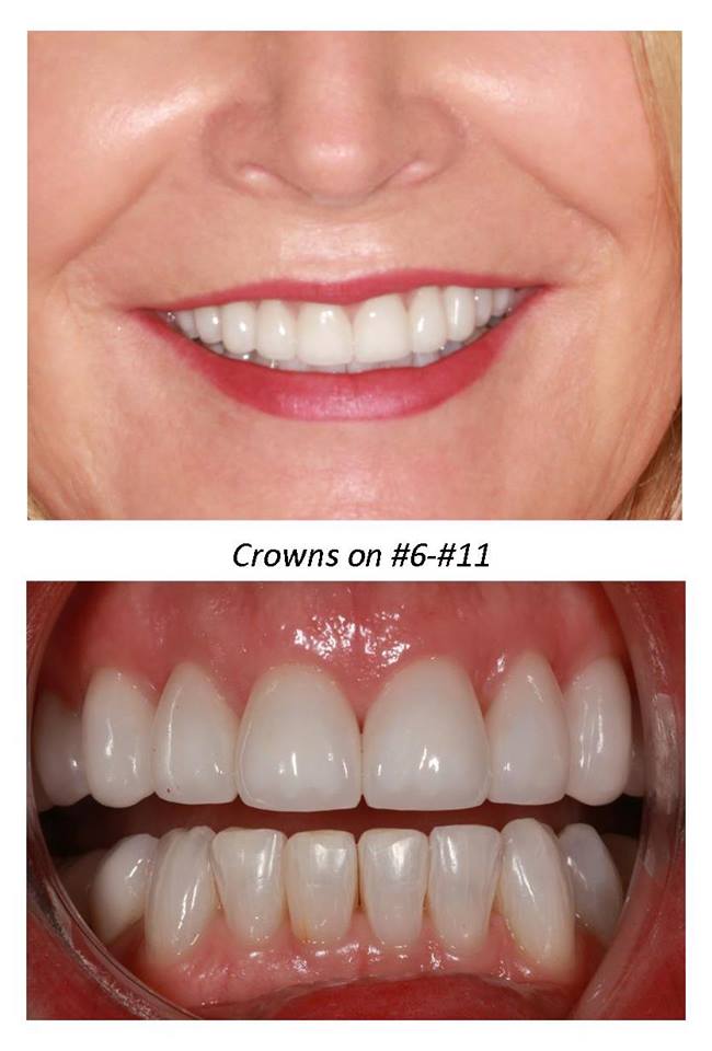 Cosmetic Dental Arts | 23220 Maple Valley Black Diamond Rd SE #3b, Maple Valley, WA 98038, USA | Phone: (425) 432-0503