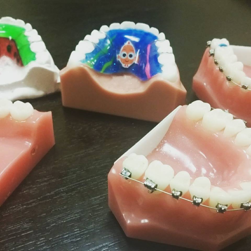 Orthodontic Appliance Company | 635 E Maryland Ave Suite B, Phoenix, AZ 85012 | Phone: (623) 253-1226