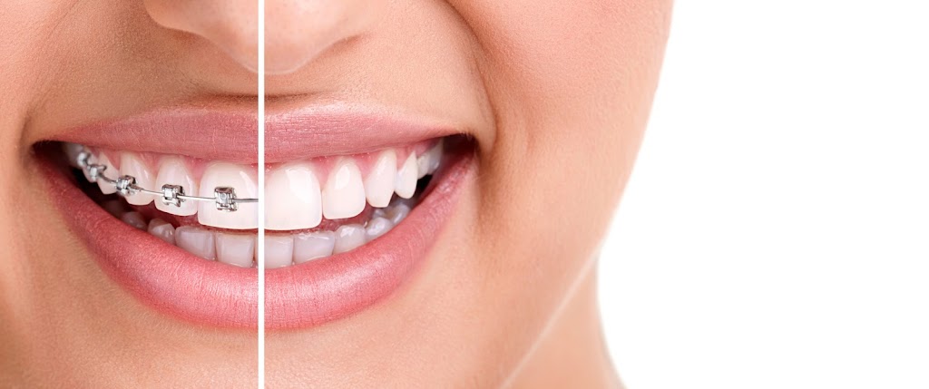 Lineberry Orthodontics | 13059 Persimmon Ln, Boise, ID 83713, USA | Phone: (208) 658-9470