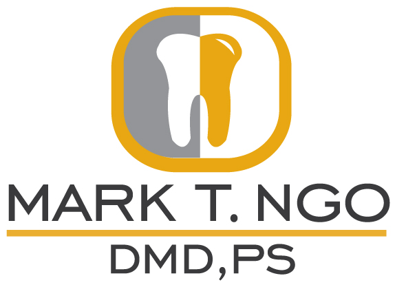 Mark T. Ngo, DMD, PS | 819 39th Ave SW suite a, Puyallup, WA 98373, USA | Phone: (253) 848-4300