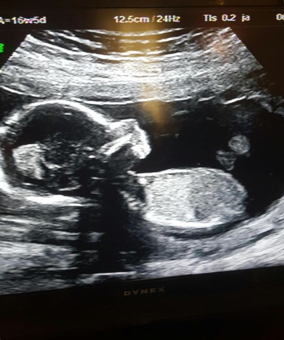 Baby Envision 4D Ultrasound of Troy | 650 E Big Beaver Rd e, Troy, MI 48083, USA | Phone: (810) 229-9899