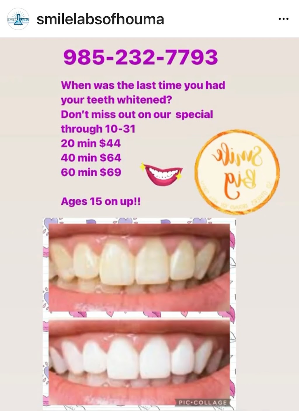 Smile Labs of Houma LLC | 112 Equity Blvd #102, Houma, LA 70360, USA | Phone: (985) 232-7793