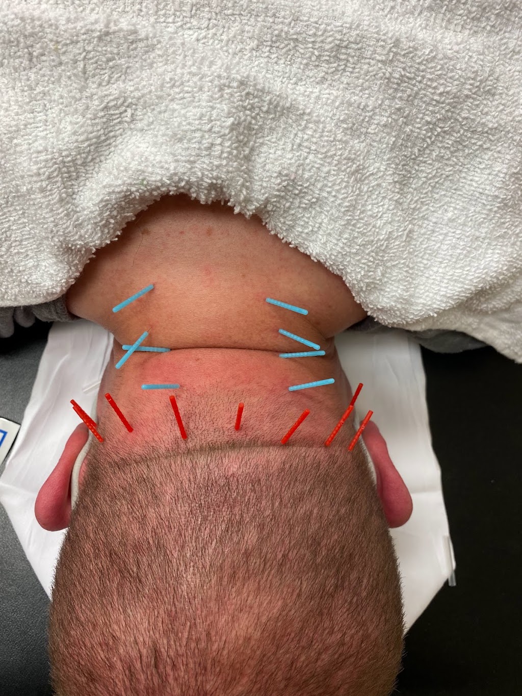 Premier Mobile Therapy | 803 Reserve Rdg Dr, Louisville, KY 40245, USA | Phone: (502) 496-6214