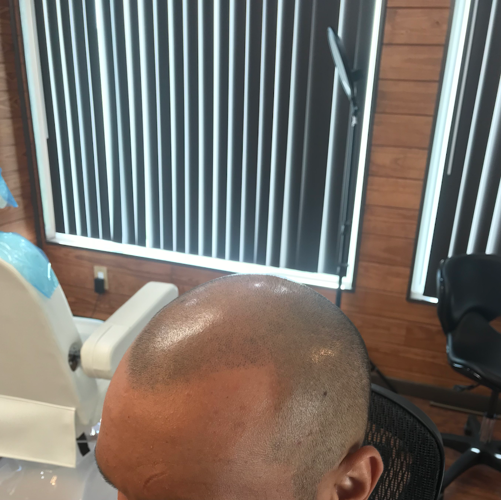 BuzzLook Scalp Pigmentation | 175 Book Rd, Slippery Rock, PA 16057, USA | Phone: (833) 642-7648